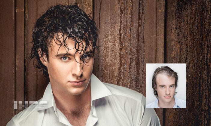 Men's Hair Loss Replacement Restoration Jacksonville FL