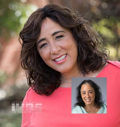 female hair loss treatment jacksonville florida