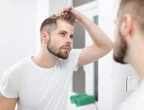 Are Millennial Men Losing Their Hair